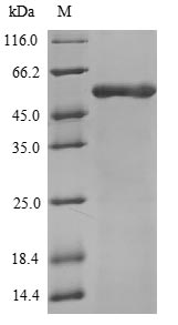 Greater than 90% as determined by SDS-PAGE.Recombinant Human Atp Synthase Subunit Beta, Mitochondrial (ATP5F1B) Protein (His)