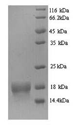 Greater than 90% as determined by SDS-PAGE.Recombinant Human Atp Synthase Subunit Delta, Mitochondrial (ATP5D) Protein (His)