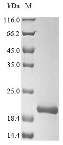 Greater than 85% as determined by SDS-PAGE.Recombinant Human Atp Synthase Subunit Delta, Mitochondrial (ATP5D) Protein (Myc&His)