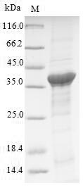 Greater than 90% as determined by SDS-PAGE.Recombinant Human Renin Receptor (ATP6AP2) Protein (His)