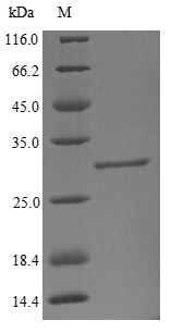 Greater than 90% as determined by SDS-PAGE.Recombinant Bovine Beta-1,4-Galactosyltransferase 1 (B4GALT1) Protein (GST)