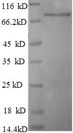 Greater than 90% as determined by SDS-PAGE.Recombinant Human Breast Carcinoma-Amplified Sequence 1 (BCAS1) Protein (His)