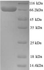 Greater than 90% as determined by SDS-PAGE.Recombinant Human Cholinesterase (BCHE) Protein (His)