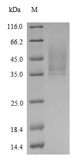 Greater than 90% as determined by SDS-PAGE.Recombinant Human Probetacellulin (BTC) Protein (His)