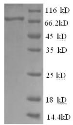 Greater than 90% as determined by SDS-PAGE.Recombinant Human Tyrosine-Protein Kinase Btk (BTK) Protein (His)