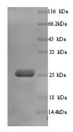 Greater than 90% as determined by SDS-PAGE.Recombinant Human Butyrophilin Subfamily 3 Member A3 (BTN3A3) Protein (His)