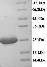 Greater than 90% as determined by SDS-PAGE.Recombinant Mouse Complement C1Q Subcomponent Subunit A (C1QA) Protein (His)