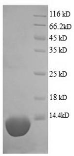 Greater than 90% as determined by SDS-PAGE.Recombinant Pig Complement C5A Anaphylatoxin (C5) Protein (His)