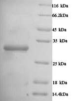 Greater than 90% as determined by SDS-PAGE.Recombinant Human Carbonic Anhydrase 1 (CA1) Protein (His)
