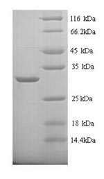 Greater than 90% as determined by SDS-PAGE.Recombinant Rat Carbonic Anhydrase 1 (CA1) Protein (His)