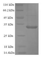 Greater than 90% as determined by SDS-PAGE.Recombinant Human Carbonic Anhydrase 12 (CA12) Protein (His)