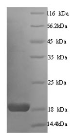 Greater than 90% as determined by SDS-PAGE.Recombinant Human Calmodulin (CALM1) Protein (His)