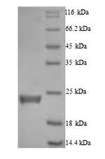 Greater than 90% as determined by SDS-PAGE.Recombinant Human Caspase-5 (CASP5) Protein (His)