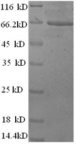 Greater than 90% as determined by SDS-PAGE.Recombinant Human Extracellular Calcium-Sensing Receptor (CASR) Protein (His)