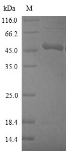 Greater than 90% as determined by SDS-PAGE.Recombinant Human Cystathionine Beta-Synthase (CBS) Protein (His)