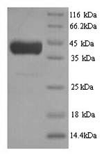 Greater than 90% as determined by SDS-PAGE.Recombinant Saccharomyces Cerevisiae Cystathionine Beta-Synthase (CYS4) Protein (His)