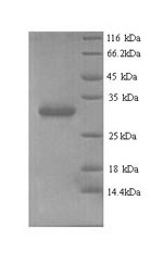 Greater than 90% as determined by SDS-PAGE.Recombinant Human Chromobox Protein Homolog 7 (CBX7) Protein (His)
