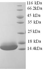 Greater than 90% as determined by SDS-PAGE.Recombinant Human Cyclin-J-Like Protein (CCNJL) Protein (His)