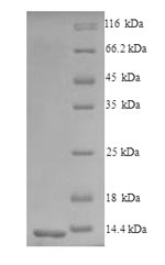 Greater than 90% as determined by SDS-PAGE.Recombinant Mouse C-C Chemokine Receptor Type 5 (CCR5) Protein (His/Tag-Free)