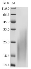 Greater than 90% as determined by SDS-PAGE.Recombinant Human C-C Chemokine Receptor Type 8 (CCR8) Protein (His-Myc)