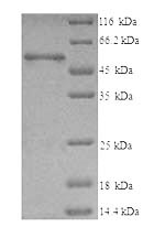 Greater than 90% as determined by SDS-PAGE.Recombinant Human T-Complex Protein 1 Subunit Beta (CCT2) Protein (His)