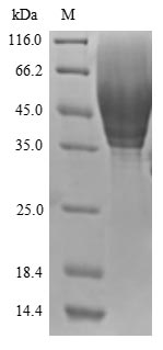 Greater than 85% as determined by SDS-PAGE.Recombinant Human Cd63 Antigen (CD63) Protein (His-sumostar)