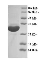 Greater than 90% as determined by SDS-PAGE.Recombinant Mouse Macrosialin (CD68) Protein (His)