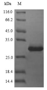 Greater than 85% as determined by SDS-PAGE.Recombinant Human Cyclin-Dependent Kinase Inhibitor 3 (CDKN3) Protein (His)