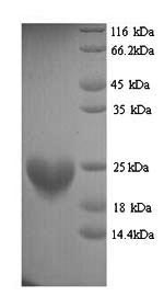 Greater than 90% as determined by SDS-PAGE.Recombinant Mouse Histone H3-Like Centromeric Protein A (CENPA) Protein (His)