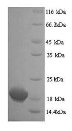 Greater than 90% as determined by SDS-PAGE.Recombinant Human Clathrin Heavy Chain 2 (CLTCL1) Protein (His)