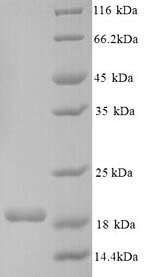 Greater than 90% as determined by SDS-PAGE.Recombinant Human Connector Enhancer Of Kinase Suppressor Of Ras 2 (CNKSR2) Protein (His)