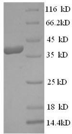 Greater than 90% as determined by SDS-PAGE.Recombinant Human Mast Cell Carboxypeptidase A (CPA3) Protein (His)