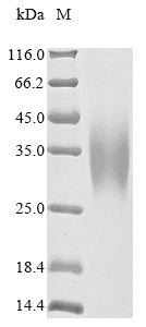 Greater than 90% as determined by SDS-PAGE.Recombinant Human Carbamoyl-Phosphate Synthase [Ammonia], Mitochondrial (CPS1) Protein (His)