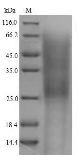 Greater than 90% as determined by SDS-PAGE.Recombinant Mouse Complement Receptor Type 2 (CR2) Protein (His)
