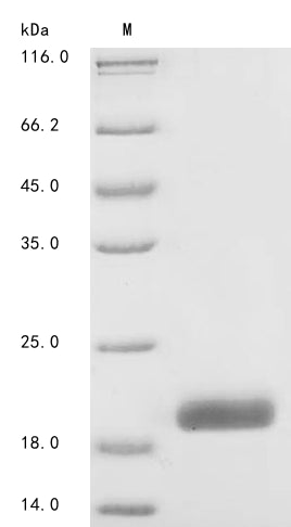Greater than 90% as determined by SDS-PAGE.Recombinant Human Macrophage Colony-Stimulating Factor 1 (CSF1) Protein (His)