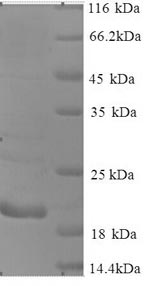 Greater than 90% as determined by SDS-PAGE.Recombinant Human Cancer/Testis Antigen 1 (CTAG1A) Protein (His)