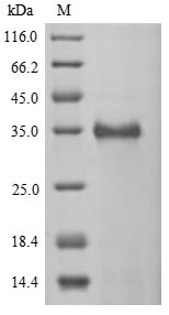 Greater than 85% as determined by SDS-PAGE.Recombinant Human Cancer/Testis Antigen 2 (CTAG2) Protein (His-sumostar)