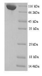 Greater than 90% as determined by SDS-PAGE.Recombinant Mouse Transcriptional Repressor Ctcfl (CTCFL) Protein (His)