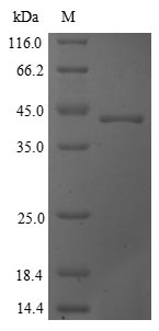 Greater than 90% as determined by SDS-PAGE.Recombinant Saccharomyces Cerevisiae Cystathionine Gamma-Lyase (CYS3) Protein (His)