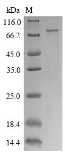 Greater than 90% as determined by SDS-PAGE.Recombinant Human Ctp Synthase 1 (CTPS1) Protein (His)