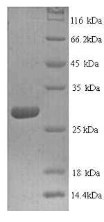Greater than 90% as determined by SDS-PAGE.Recombinant Human Cathepsin K (CTSK) Protein (His)