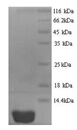 Greater than 90% as determined by SDS-PAGE.Recombinant Human C-X-C Motif Chemokine 10 (CXCL10) Protein (His)