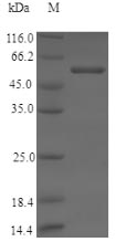 Greater than 90% as determined by SDS-PAGE.Recombinant Human Cytochrome P450 11B2, Mitochondrial (CYP11B2) Protein (His)