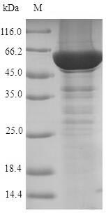 Greater than 90% as determined by SDS-PAGE.Recombinant Human Steroid 21-Hydroxylase (CYP21A2) Protein (His)
