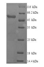 Greater than 90% as determined by SDS-PAGE.Recombinant Mouse Cytochrome P450 2E1 (CYP2E1) Protein (His)