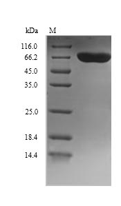 Greater than 90% as determined by SDS-PAGE.Recombinant Human Dopamine Beta-Hydroxylase (DBH) Protein (His)