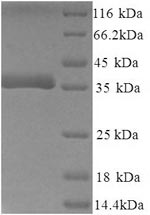 Greater than 90% as determined by SDS-PAGE.Recombinant Mouse Decorin (DCN) Protein (His)