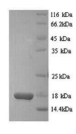 Greater than 90% as determined by SDS-PAGE.Recombinant Mouse D-Dopachrome Decarboxylase (DDT) Protein (His)