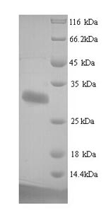 Greater than 90% as determined by SDS-PAGE.