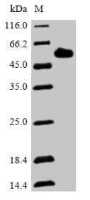 Greater than 85% as determined by SDS-PAGE.Recombinant Human Dentin Matrix Acidic Phosphoprotein 1 (DMP1) Protein (His)